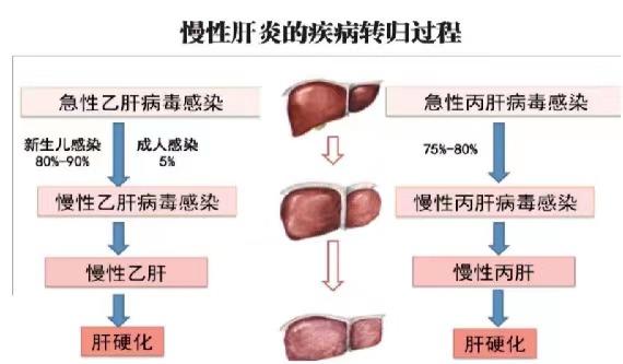 【健康科普】世界肝炎日——堅(jiān)持早預(yù)防，加強(qiáng)檢測(cè)發(fā)現(xiàn)，規(guī)范抗病毒治療